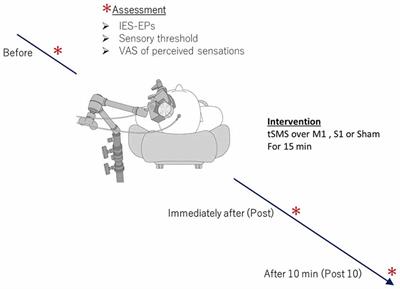 Transcranial Static Magnetic Field Stimulation over the Primary Motor Cortex Induces Plastic Changes in Cortical Nociceptive Processing